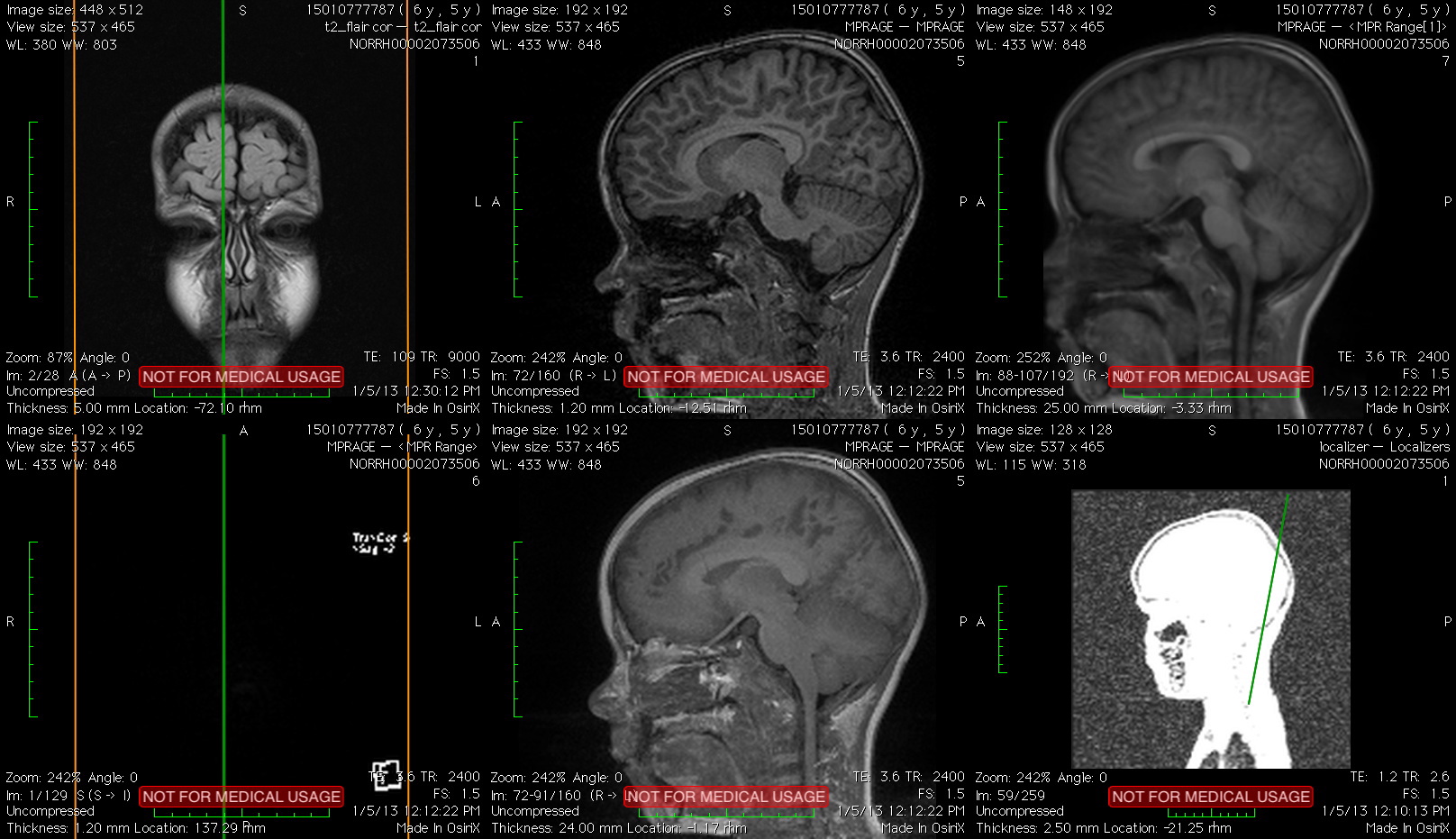 Artwork presentation of Haraldur Karlsson