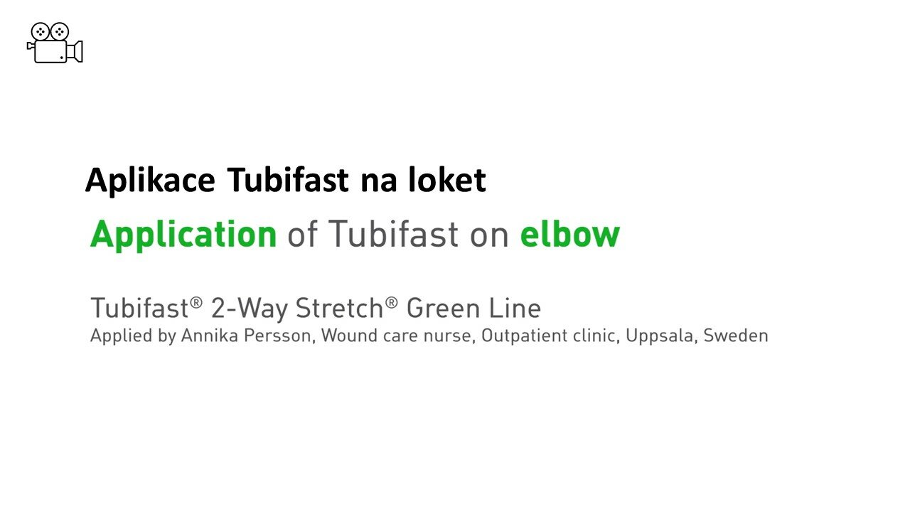 Tubifast na loket