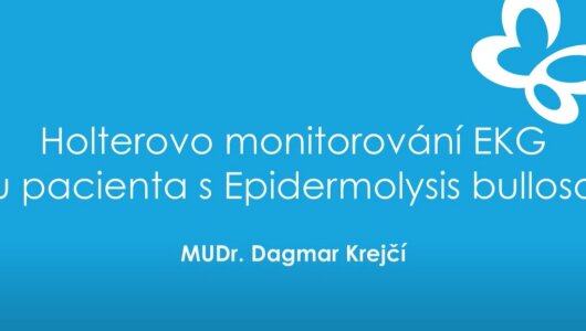 Obr. k videu Holterovo monitorování